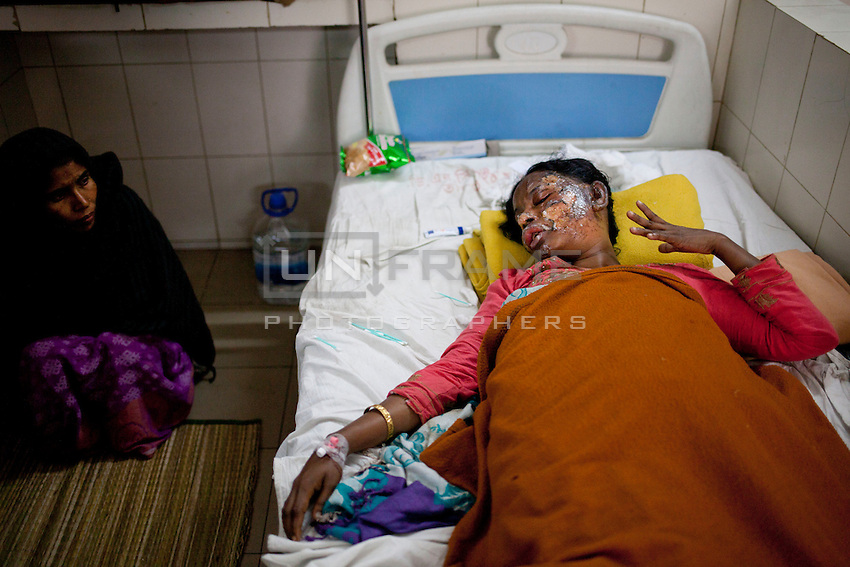 Nurjahan, 35, one of the victims of a recent bomb attack in a bus, receives treatment at a medical college hospital during the ongoing nationwide blockade called by the opposition Bangladesh Nationalist Party (BNP), in Dhaka, Bangladesh, Sunday, Jan. 18, 2015.