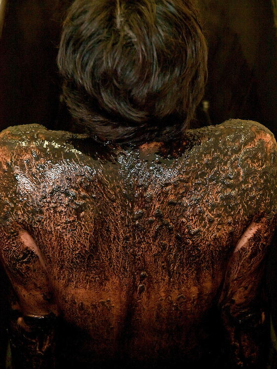 Woman at the Cartellieri house for a bath with sulphite/ferrous mud. The rich local deposits of sulphur-ferric peat are used for packs and baths at the spa resort of Frantiskovy Lazne in Czech Republic.